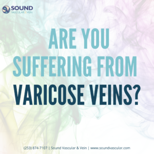 Expert Answers to Your Varicose Vein Questions: Trusted Care in Seattle